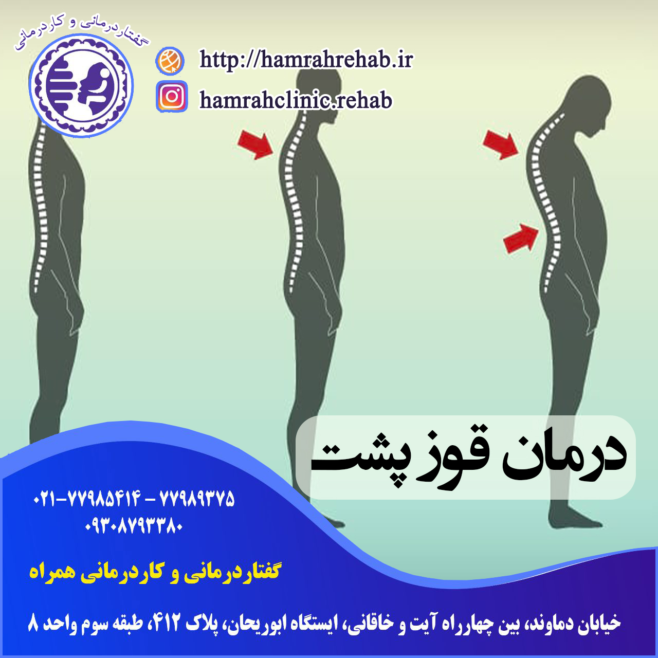 درمان قوزپشت در شرق تهران