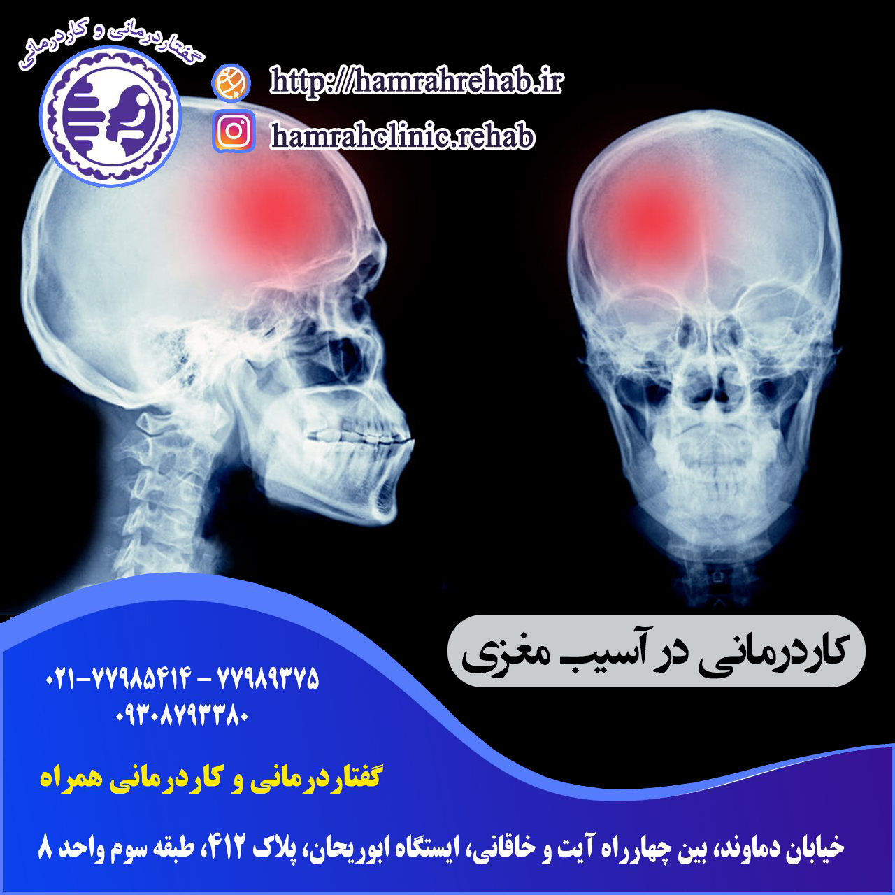 کاردرمانی آسیب مغزی در شرق تهران