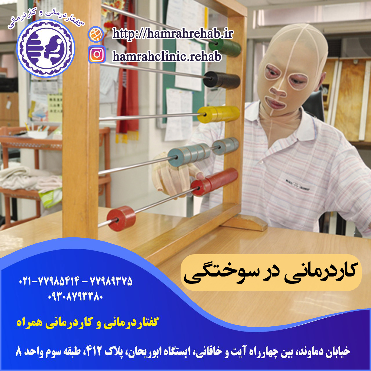 کاردرمانی سوختگی در شرق تهران