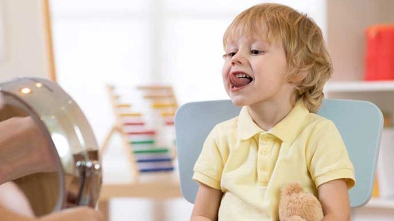 اختلال تکاملی زبان