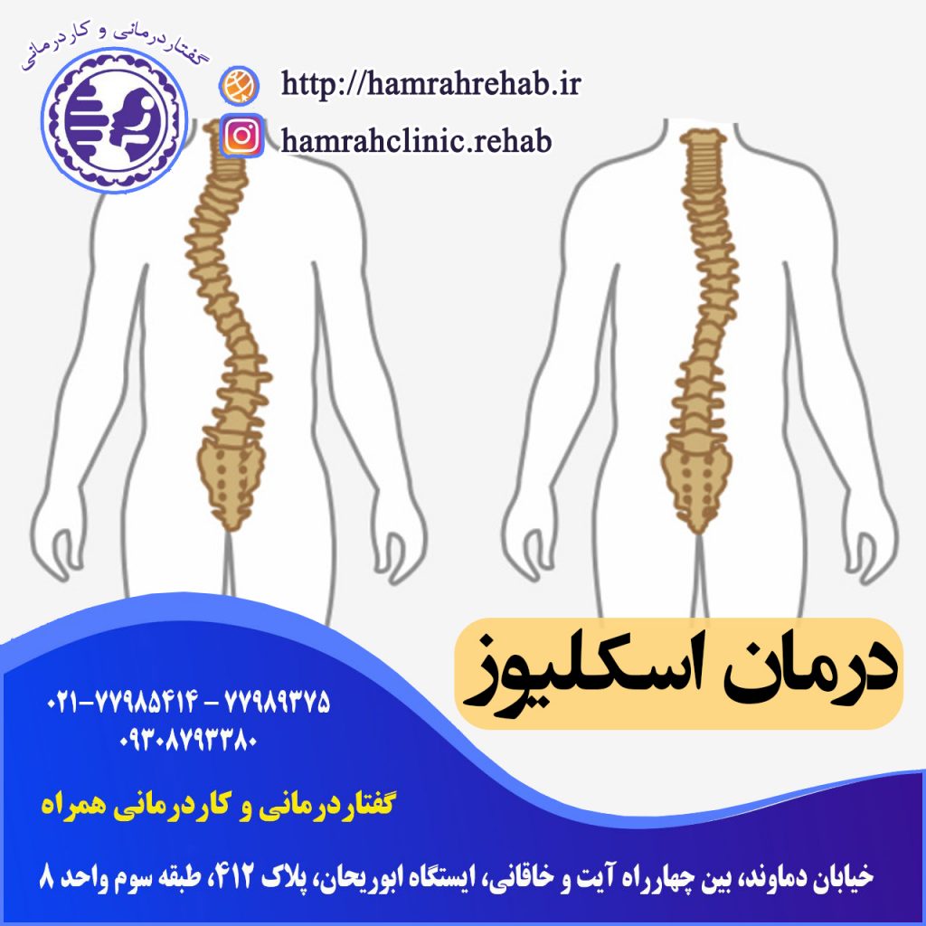 درمان اسکلیوز در شرق تهران