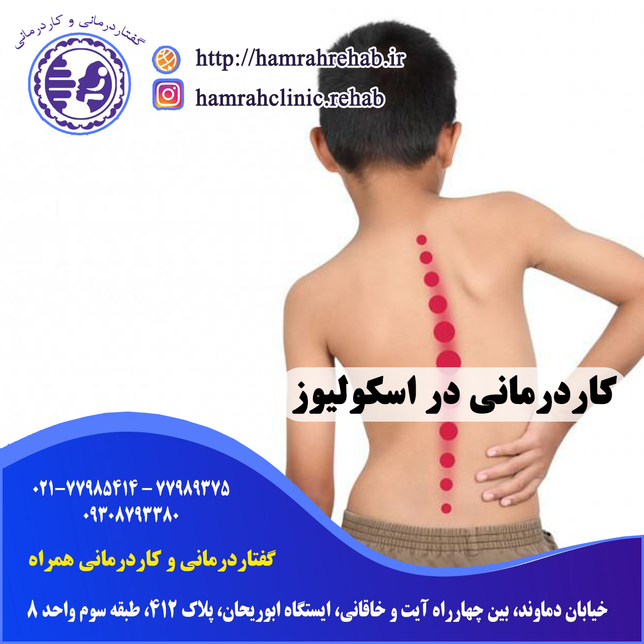 کاردرمانی در اسکولیوز در شرق تهران