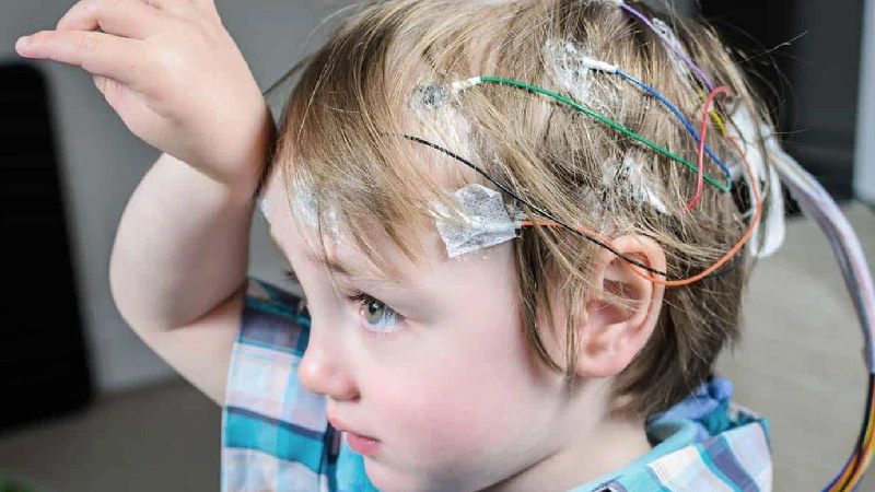 سندروم لاندو کلفنر