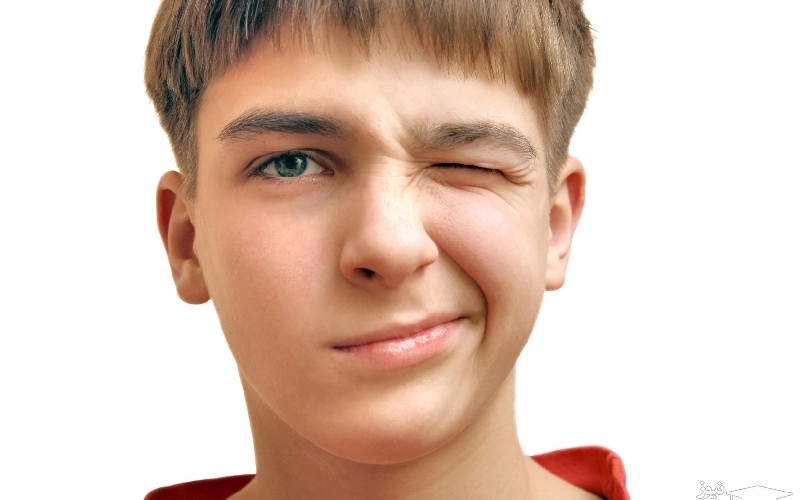 سندروم تورت