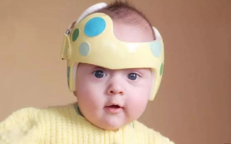 کاردرمانی کودکان هیدروسفالی