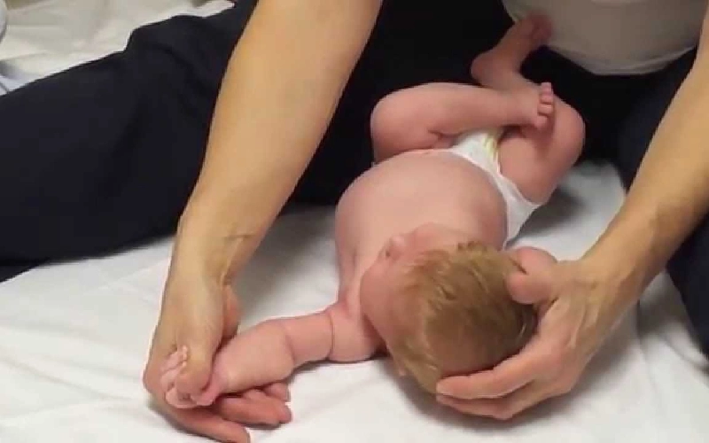 کاردرمانی فلج ارب