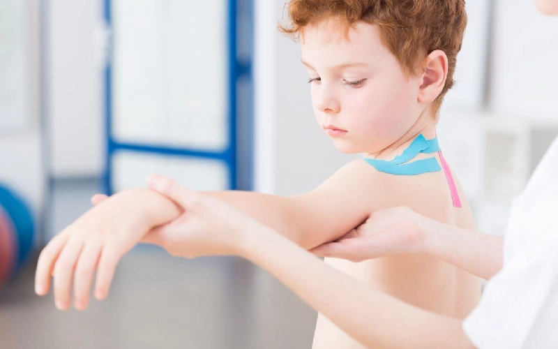 کاردرمانی فلج ارب