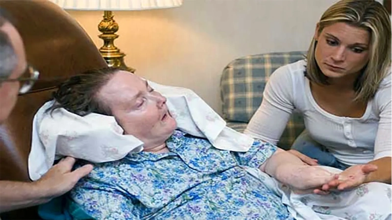 بیماری هانتینگتون